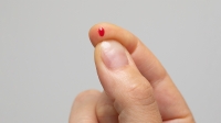 Finger-Prick Blood Spot Intolerance Testing